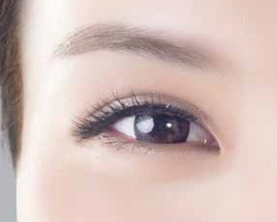 Endolift laser skin lifting London - close-up of a woman's eye and brow Close-up of a woman's eye and brow for Endolift laser skin lifting in London